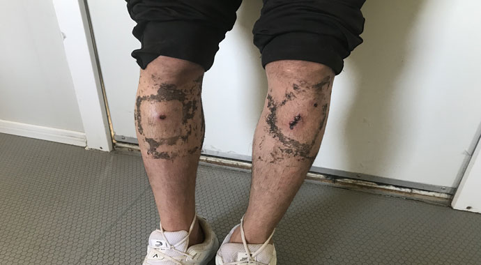 Yunanistan polisinin ‘göçmen zulmü’ devam ediyor
