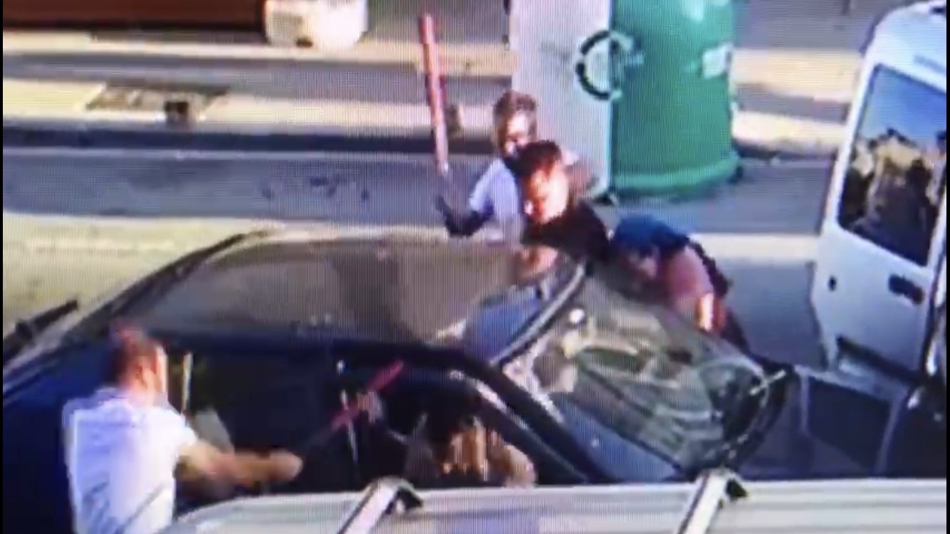 'Hannibal' damat, kayınpederinin dudağını böyle parçaladı