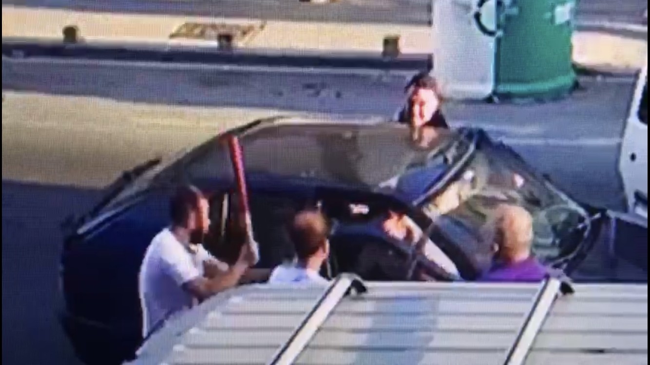 'Hannibal' damat, kayınpederinin dudağını böyle parçaladı