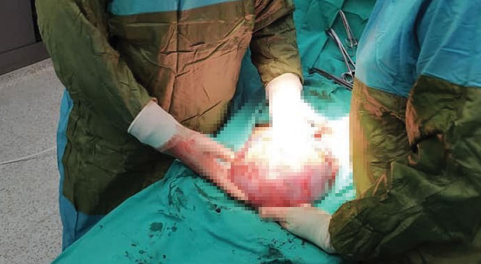 Doktorlar görünce şoke oldu! Futbol topu büyüklüğünde...