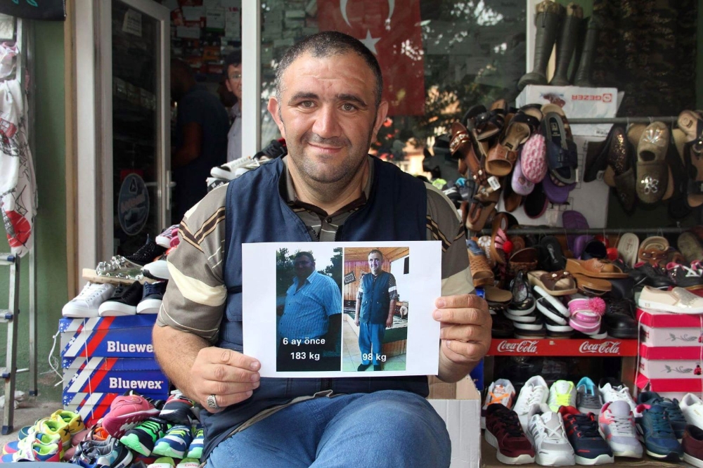 Görenleri hayrete düşürüyor! 6 ayda 85 kilo verdi