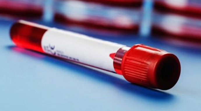 HGB (Hemoglobin) nedir? | HGB neden yaptırılır? | HGB kaç olmalı? HGB düşüklüğü, HGB yüksekliği