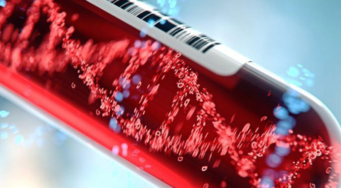 HGB (Hemoglobin) nedir? | HGB neden yaptırılır? | HGB kaç olmalı? HGB düşüklüğü, HGB yüksekliği