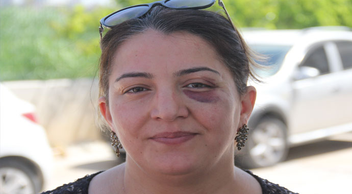 Yaralıya müdahale eden hemşire bu hale getirildi