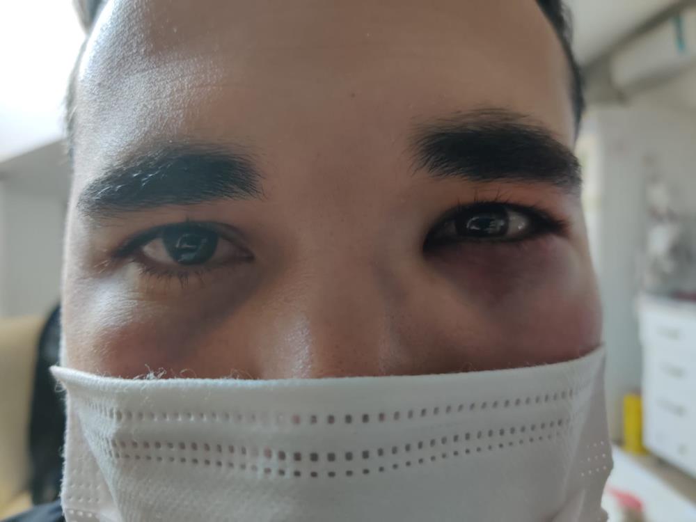 Gaziosmanpaşa'da hemşireye saldıran şüphelilerden biri gözaltına alındı