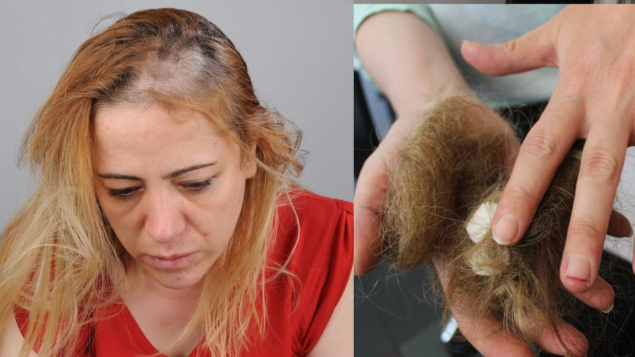 Hasta hemşireye saldırdı, saçlarını yoldu