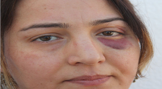 Yaralıya müdahale eden hemşire bu hale getirildi