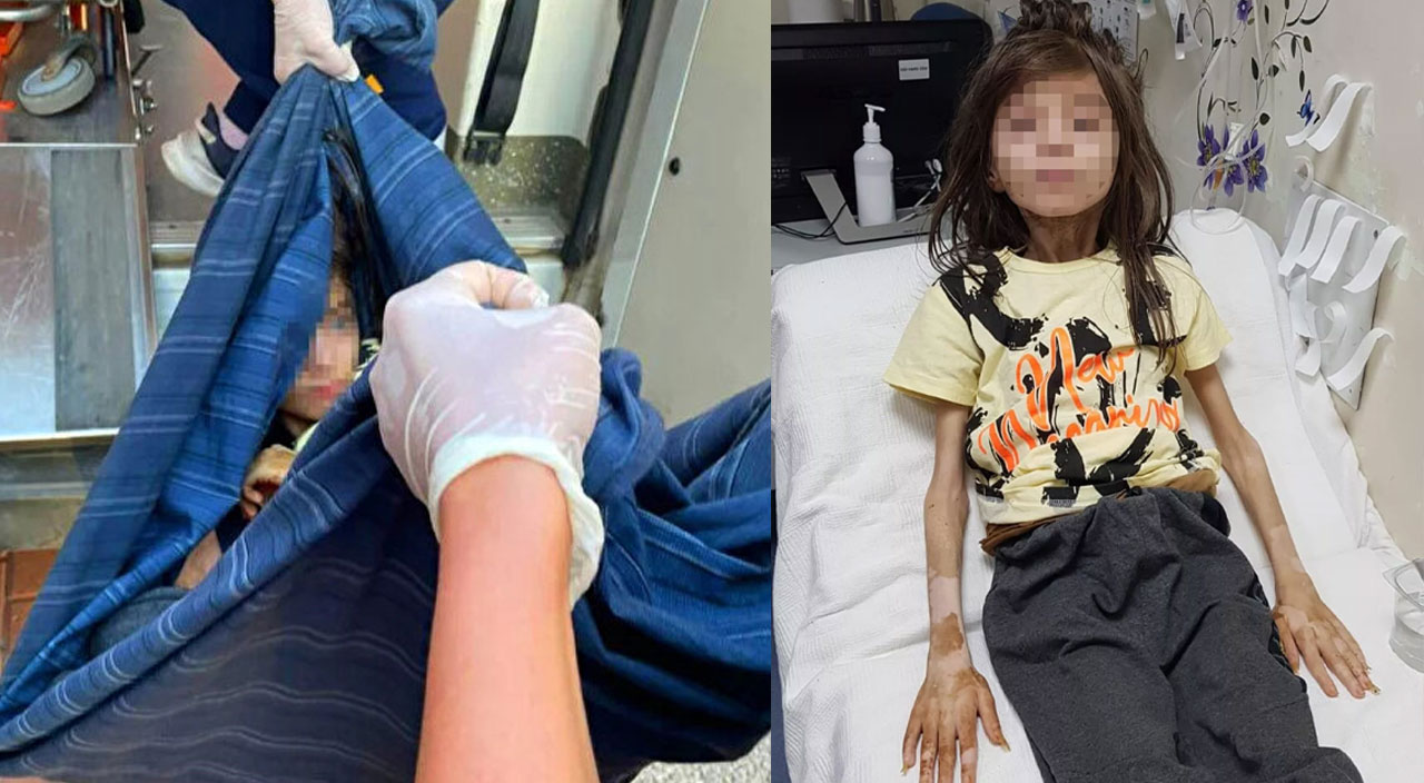 Çöp evde bitkin halde bulunan Cem Muhammet'ten iyi haber