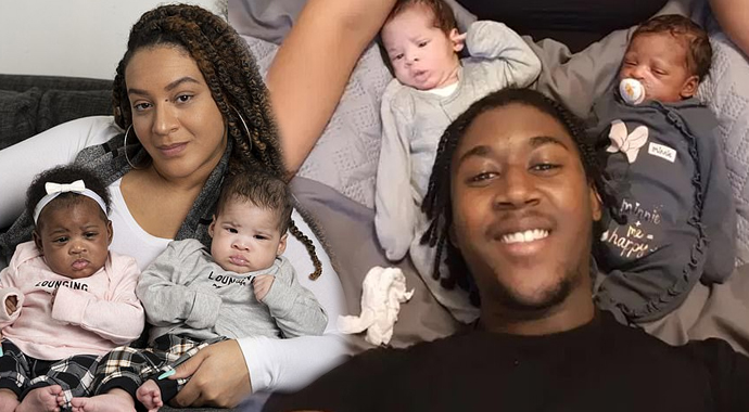 İkizlerden biri siyah biri beyaz