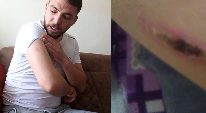 Patlayan cep telefonu yaraladı