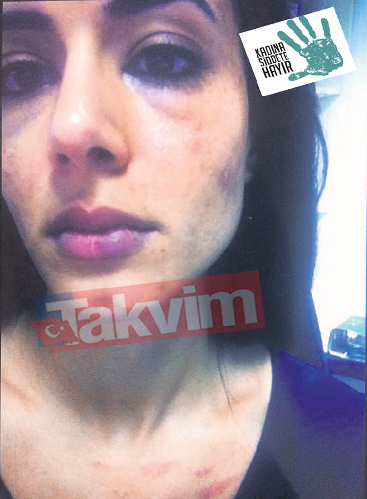 İbrahim Toraman eşini böyle dövmüş