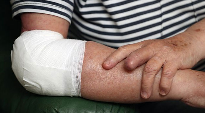 Yaşlı kadının yüzünü parçalayan pitbullun sahibine 2,5 sene hapis