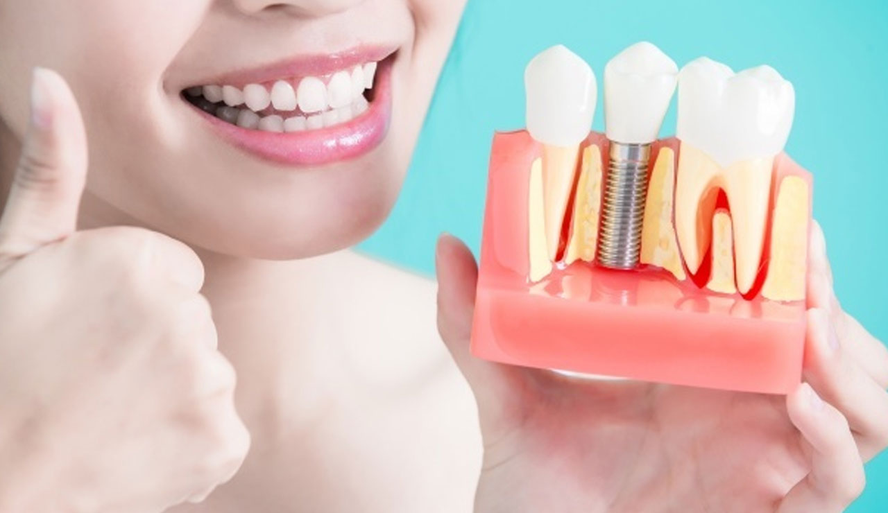 Dişimize de göz diktiler: İmplantta 'made in Germany' oyunu