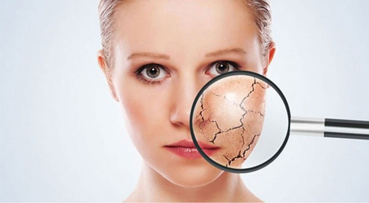 Kışın cilt bakımınız için uzmanından 10 tüyo