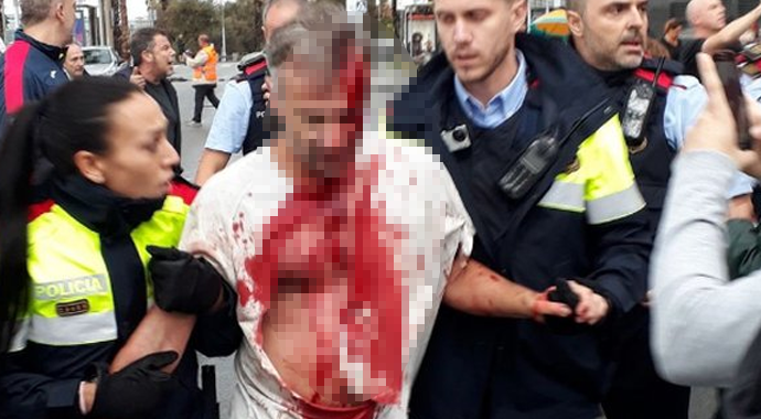 İspanyol polisinden kanlı müdahale