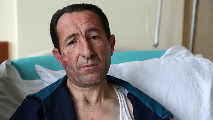 Ankara saldırısında kahraman şoför yaralı halde yolculara yardım etti