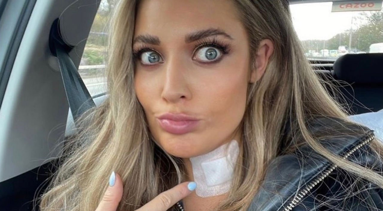 İngiliz aktris ve şarkıcı Abi Phillips tiroid kanserine yakalandı