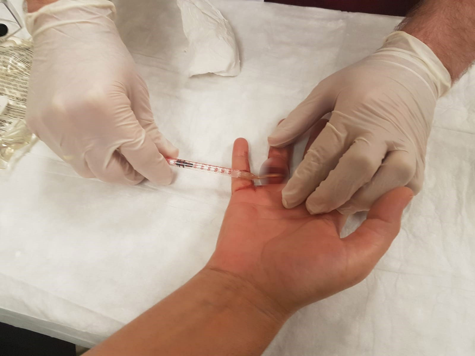 Evde temizlik yaparken düşen kadının parmağı yüzük nedeniyle sıkıştı neredeyse parmağından olacaktı