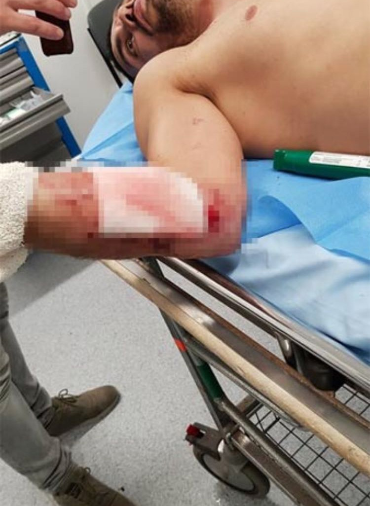 Son dakika! Kenan Sofuoğlu kaza yaptı (Kenan Sofuoğlu'nun son sağlık durumu)