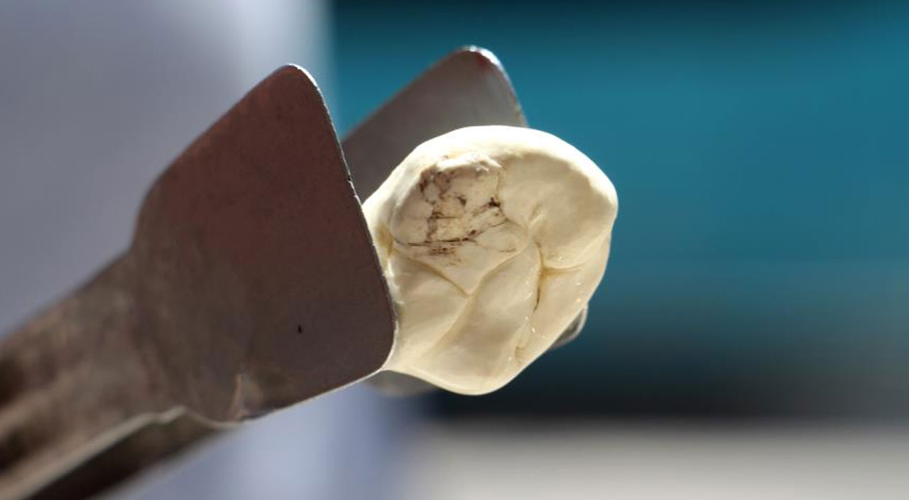 Vücutta iyi gelmediği şey yok: Karaciğeri koruyor, migrene çare oluyor Vücutta iyi gelmediği şey yok: Karaciğeri koruyor, migrene çare oluyor