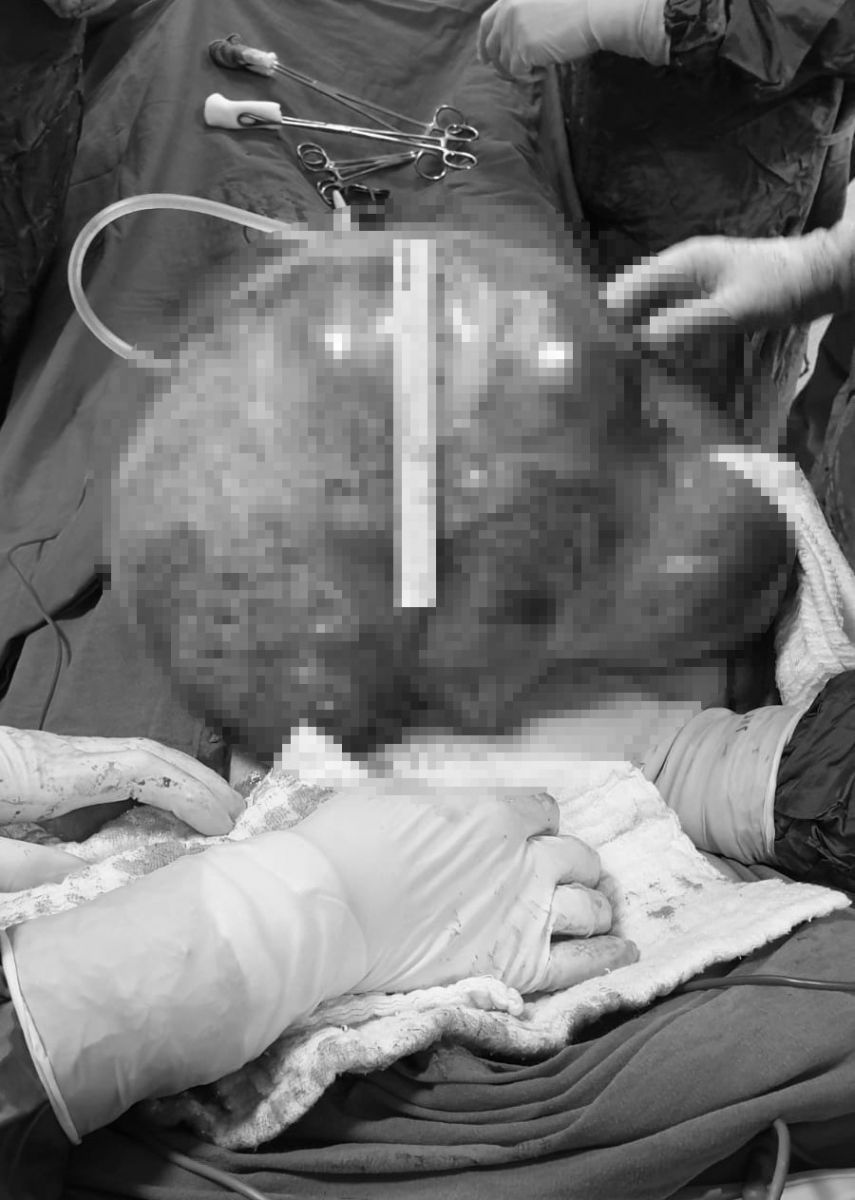 'Karnım ağrıyor' diyerek gittiği hastanede karnından 7 kiloluk kitle çıktı