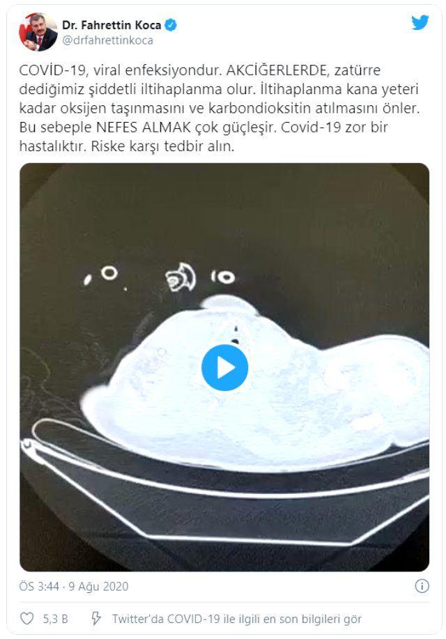 Bakan Koca Twitter'dan paylaştığı görüntüyle uyardı: Covid-19 zor bir hastalıktır