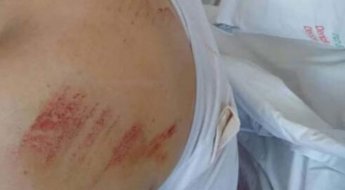 Komşu dehşeti! Talihsiz kadına nacakla saldırdı