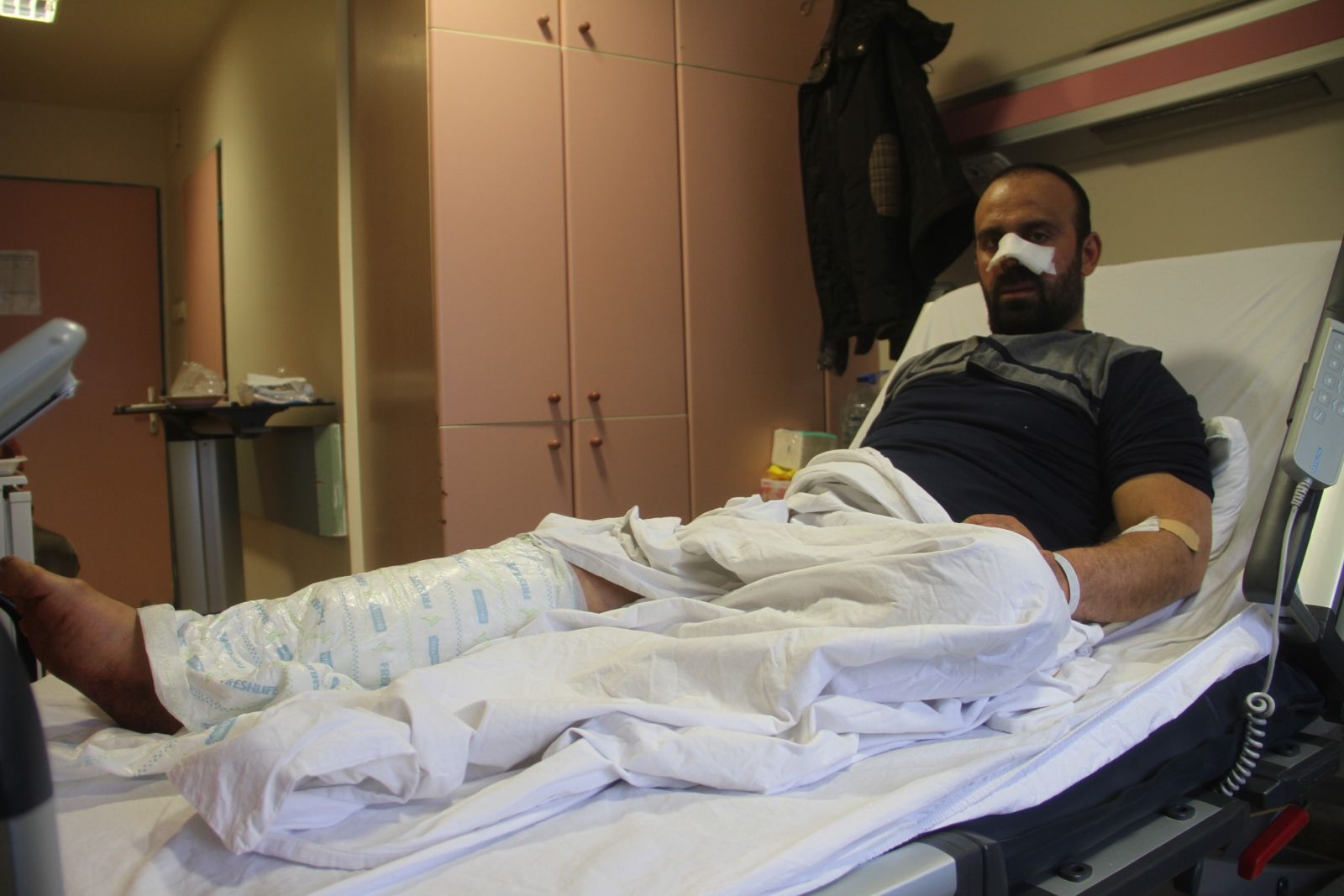 Köpekler saldırdı, burnunu ve bacağını parçaladı