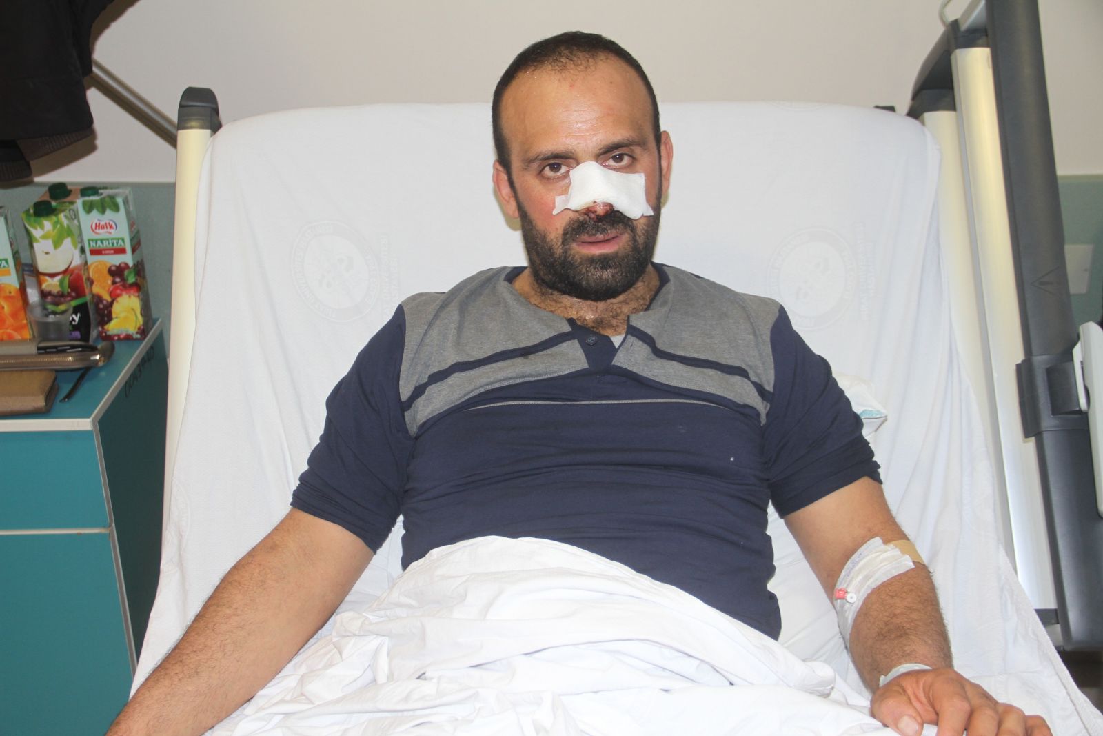 Köpekler saldırdı, burnunu ve bacağını parçaladı