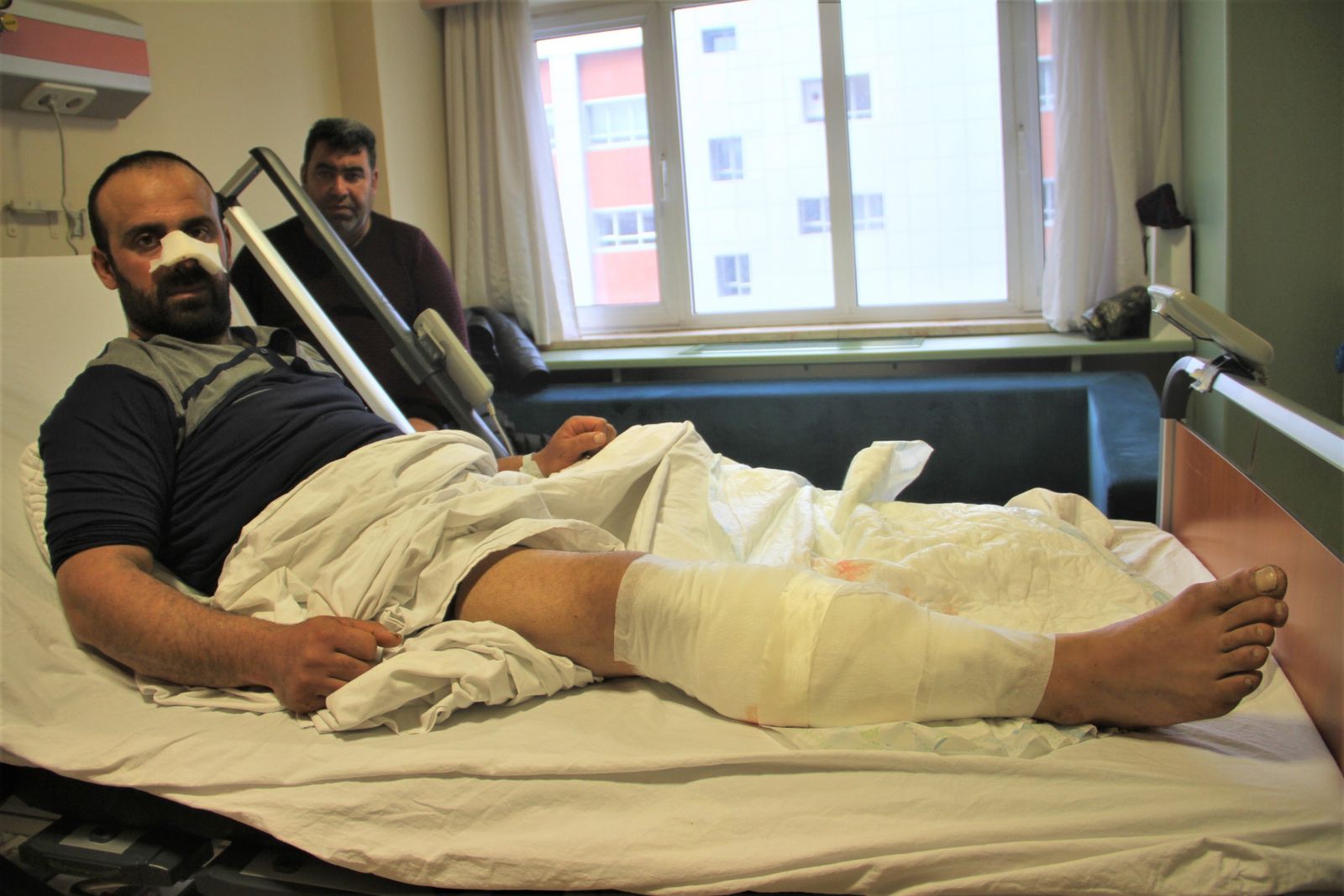 Köpekler saldırdı, burnunu ve bacağını parçaladı