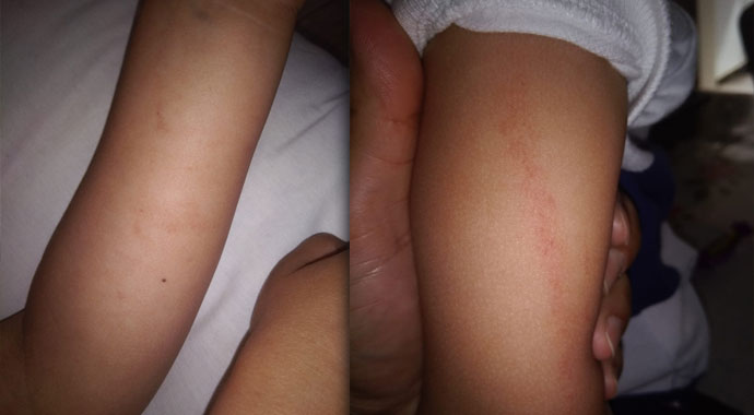 Kreşte 3 yaşındaki çocuğa darp iddiası