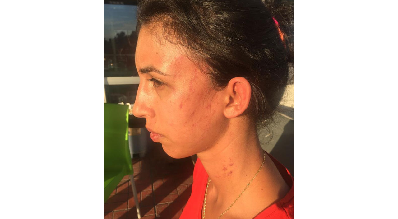 Adana’da kalemle eşine işkence yapan koca serbest bırakıldı Adana’da kalemle eşine işkence yapan koca serbest bırakıldı