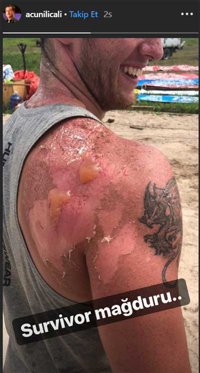 Acun Ilıcalı'dan Survivor paylaşımı... Hakan Kanık yandı!
