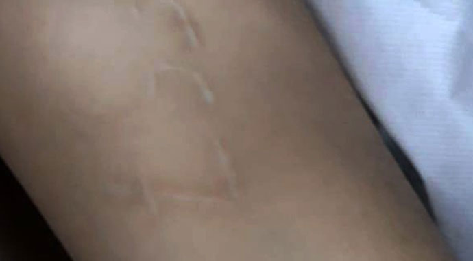 Mavi Balina'nın şifresi 'F57'