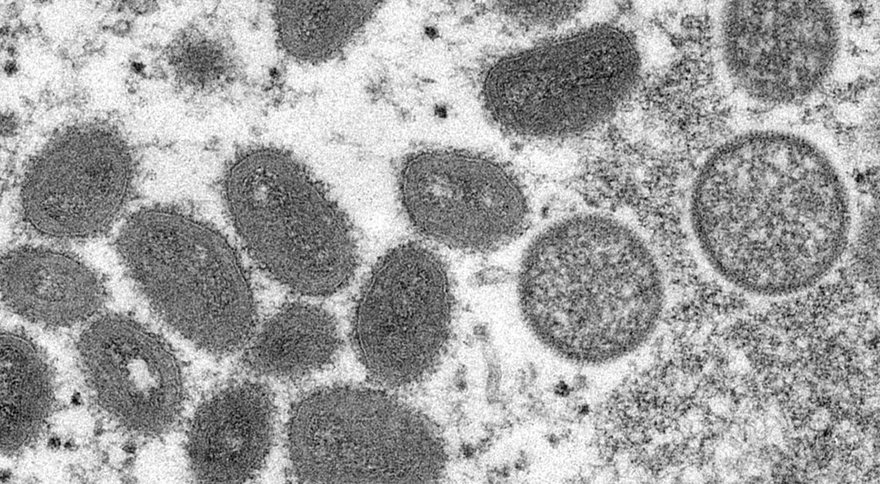 7 SORU 7 CEVAP l Git gide yayılıyor... Maymun çiçeği hastalığı hakkında ne biliyoruz?