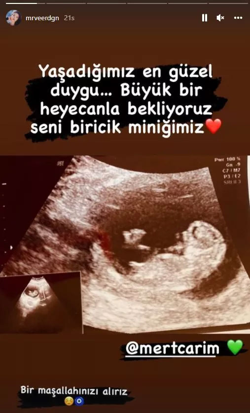 'Bücür Cadı' Merve Erdoğan anne oluyor