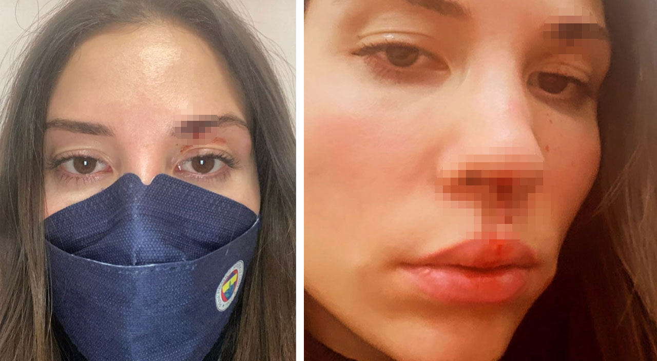 Ünlü futbolcuya eşinden darp suçlaması: Özer Hurmacı sen bir canavarsın