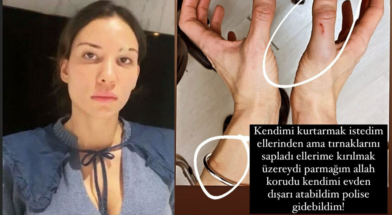 Ünlü futbolcuya eşinden darp suçlaması: Özer Hurmacı sen bir canavarsın