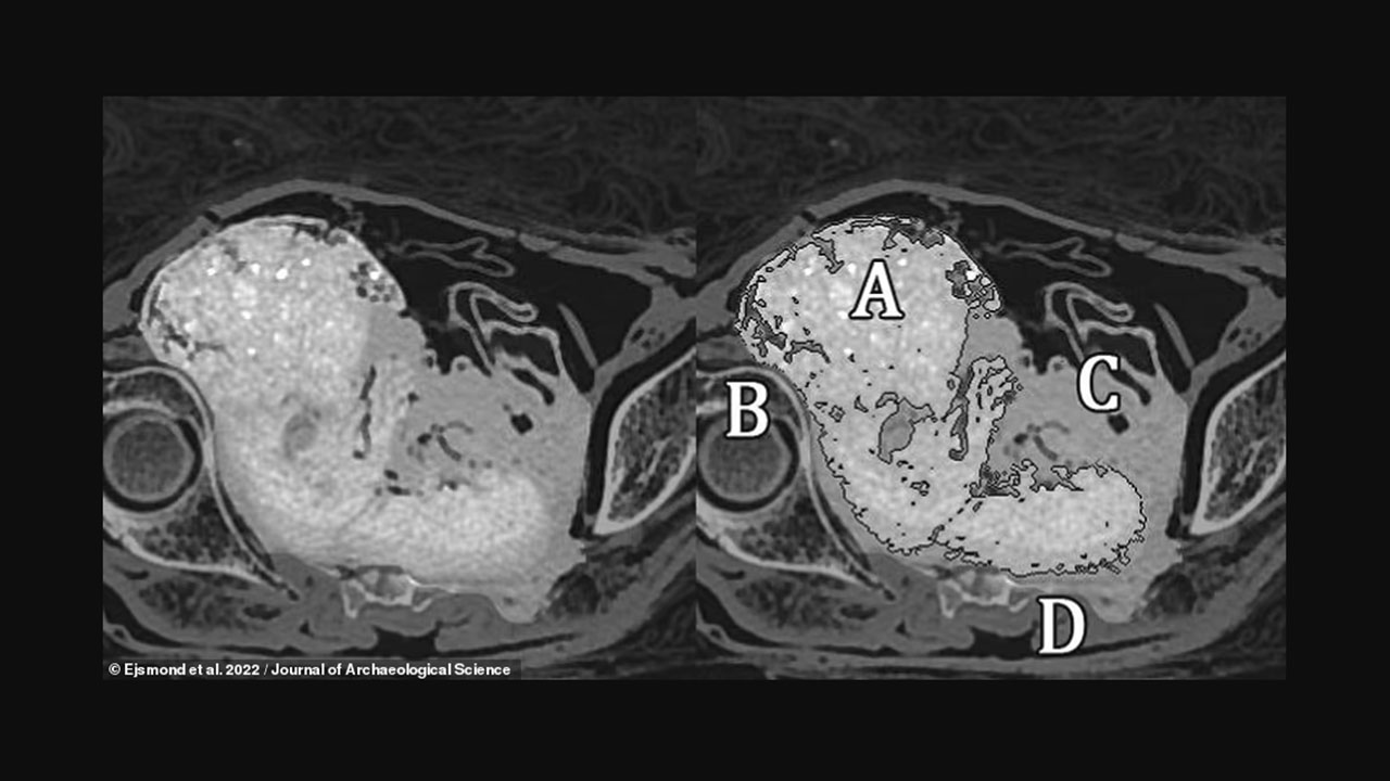 2 bin yıllık mumyanın karnındaki bebek ortaya çıktı