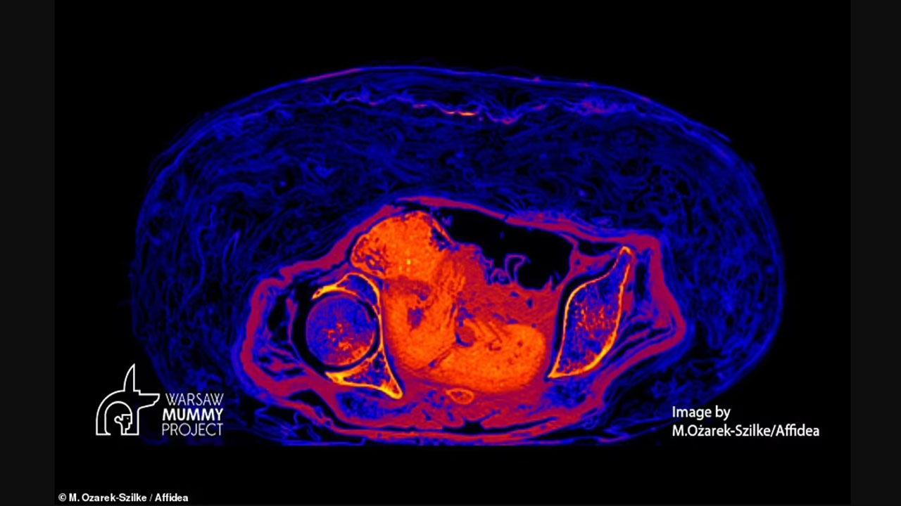 2 bin yıllık mumyanın karnındaki bebek ortaya çıktı