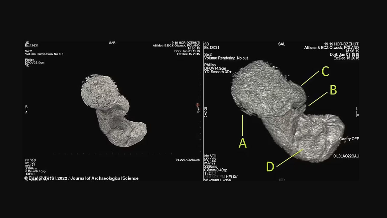 2 bin yıllık mumyanın karnındaki bebek ortaya çıktı