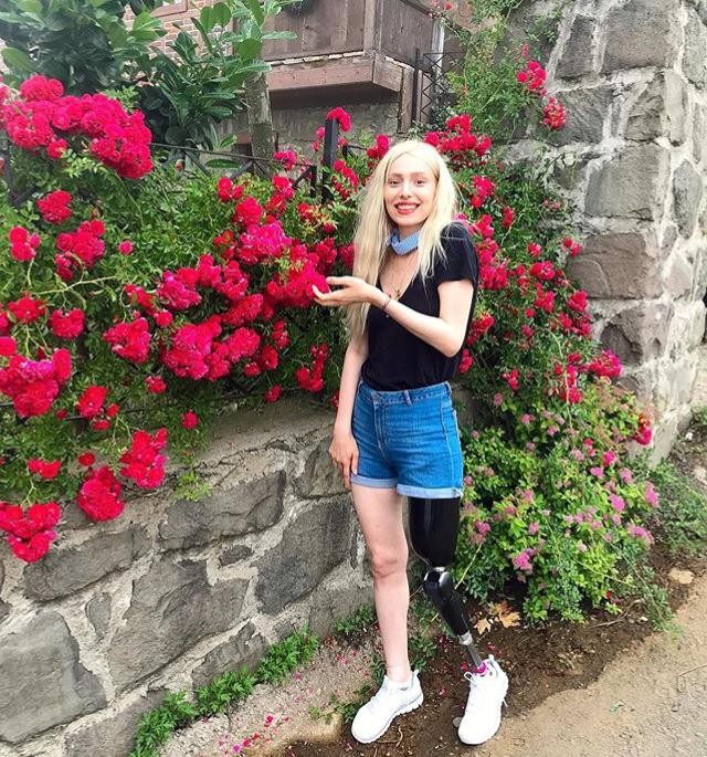 Umudun ve azmin simgesi: Neslican Tay