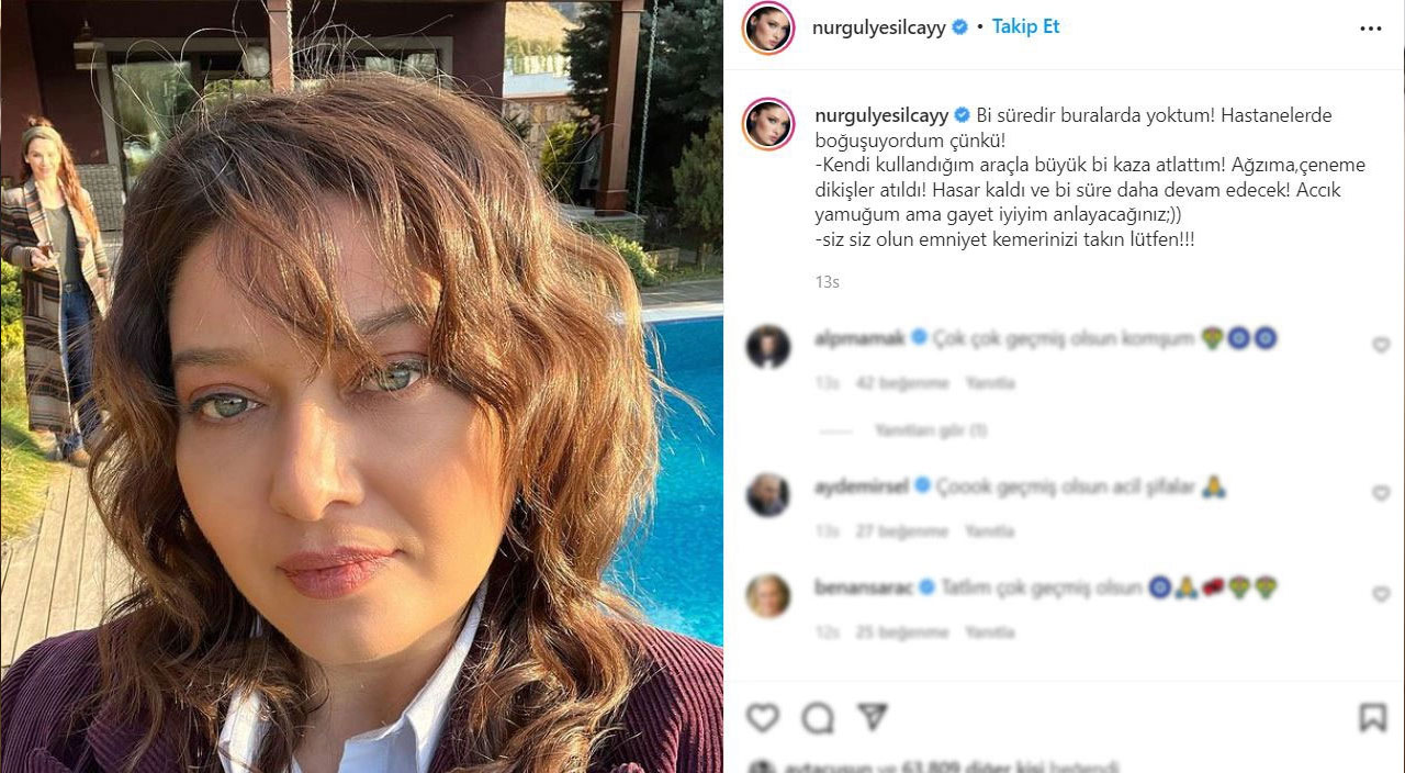 Nurgül Yeşilçay geçirdiği trafik kazası sonrası ilk kez konuştu: İzleri geçmedi, tedavim devam ediyor