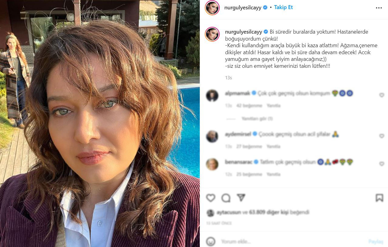 Nurgül Yeşilçay sosyal medyadan duyurdu: Büyük kaza geçirdim, hasar kaldı