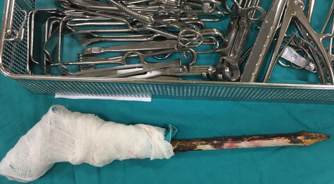 Omuzuna saplanan korkuluk demiri ile hastaneye kaldırıldı