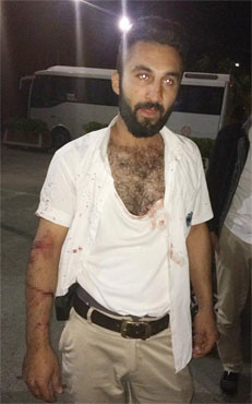 Belediye otobüsü şoförünü baba oğul dövüp bıçakladı