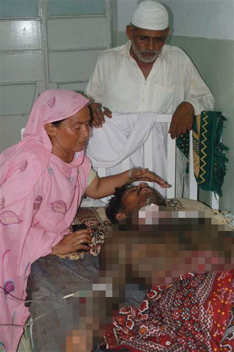 Pakistanlı kadından, evlenmek istemeyen sevgilisine korkunç ceza!
