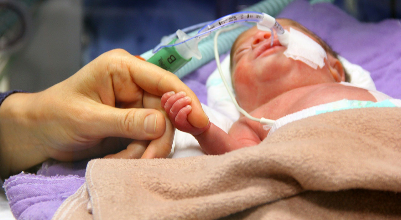 Parmak bebeğe kalp ameliyatı