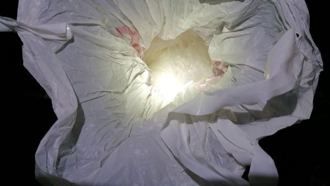 Türkiye onu yüz nakli ameliyatıyla tanımıştı: Recep Sert'ten yeni vukuat