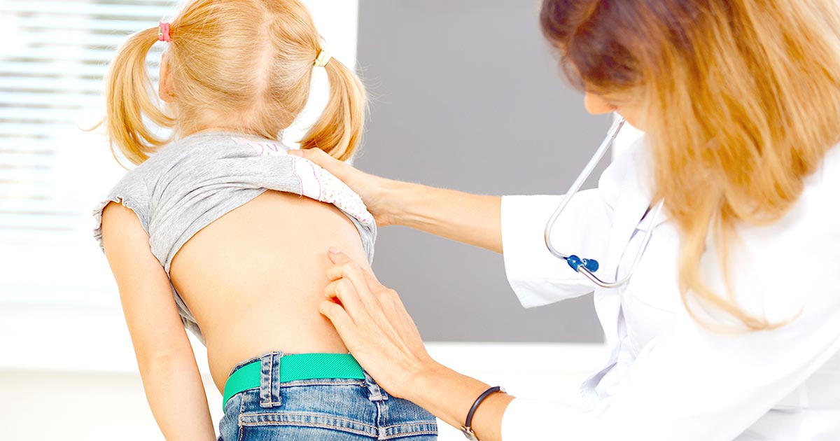 Skolyoz nedir, Skolyoz nasıl tedavi edilir? (Skolyoz Tedavi)